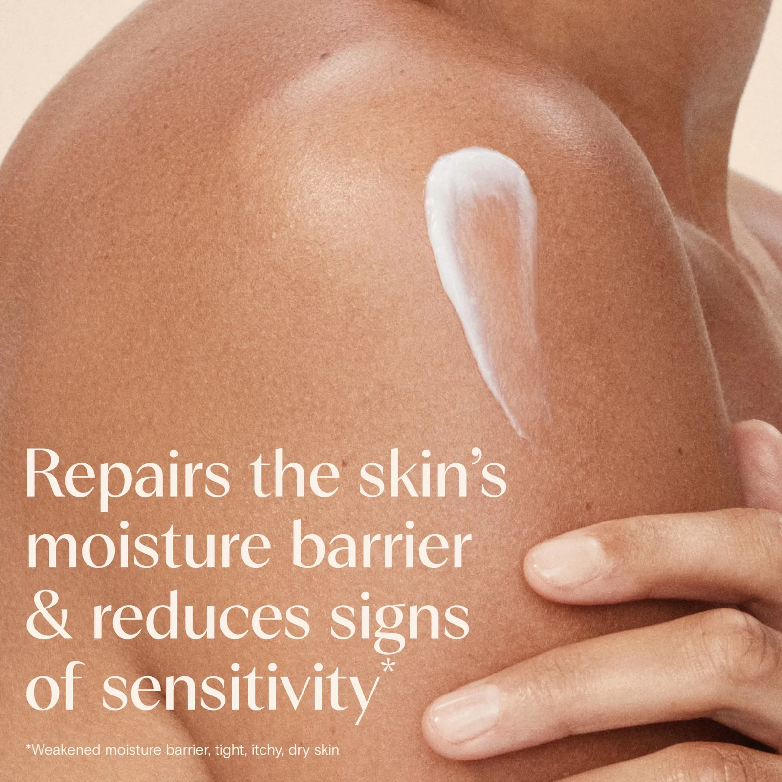 Skin Relief Moisturizing Lotion