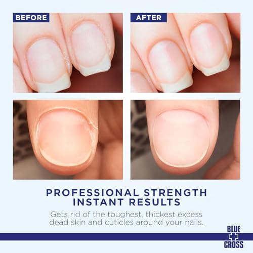 Cuticle Remover Cream