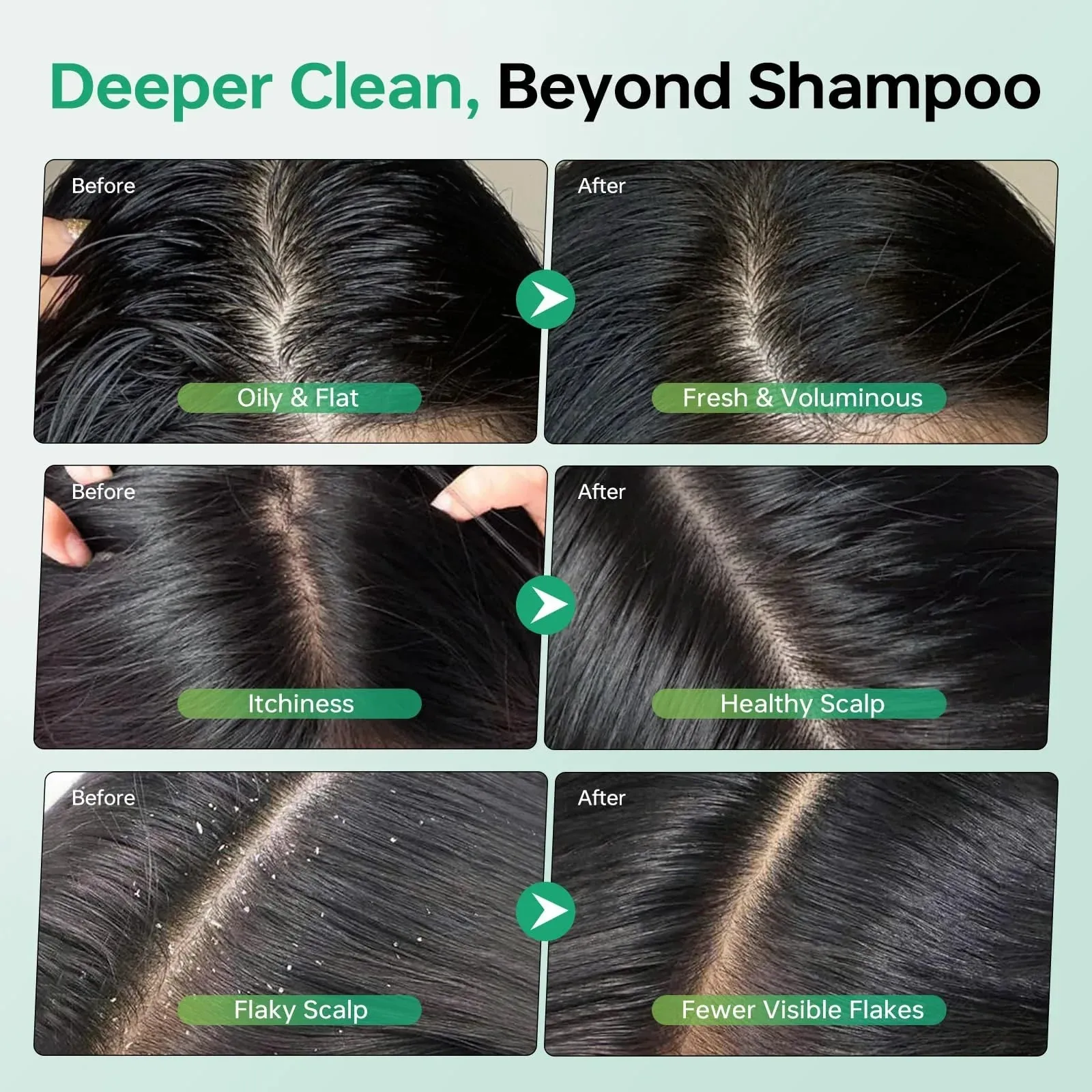Scalp Scrub, Rosemary Tea Tree Exfoliator Shampoo