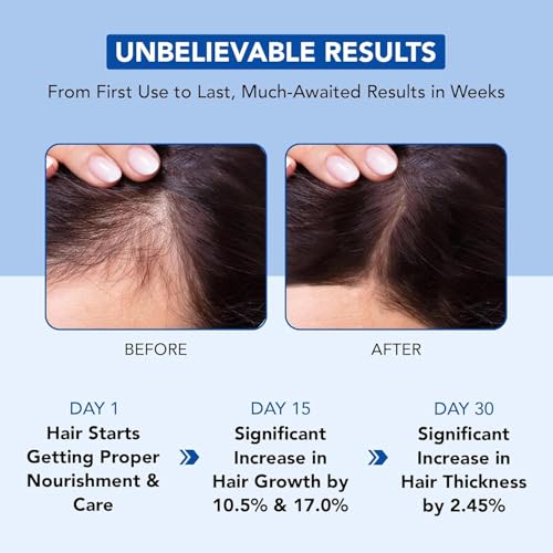 Rosemary Oil for Hair Growth