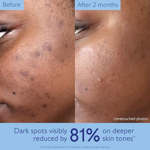 Vinoperfect Brightening Dark Spot Serum