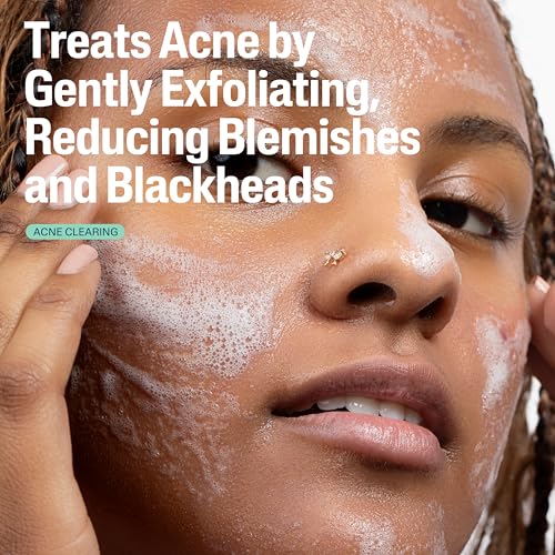 Gentle Clear Clarifying Acne Cream Cleanser foaming