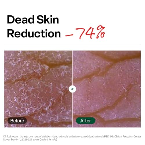 Brightening Peeling Gel