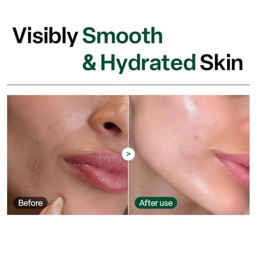 Brightening Peeling Gel