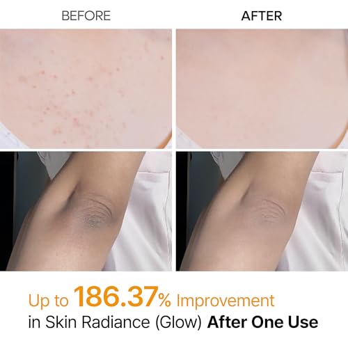 Peel Shot Kojic Acid Turmeric Body Exfoliator Spray