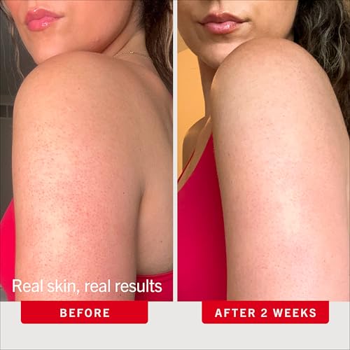 KP Bump Eraser Body Scrub