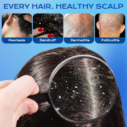 1% Ketoconazole Anti-Dandruff Shampoo