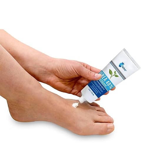 Globe Urea Cream 40% - Hydration for Dry & Cracked Heels (4 oz)