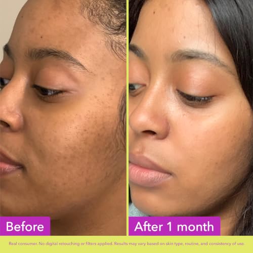 Glycolic Exfoliating Toner