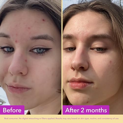 Pore & Texture Serum