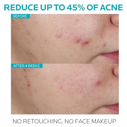 Effaclar Salicylic Acid Acne Treatment Pore Minimizer 1oz