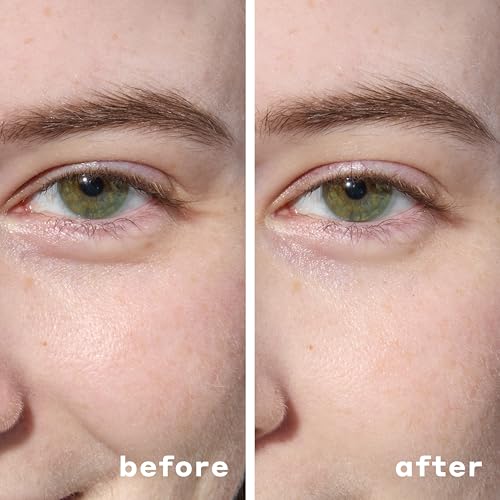 Hydrogel Under Eye Patches 30 Pairs