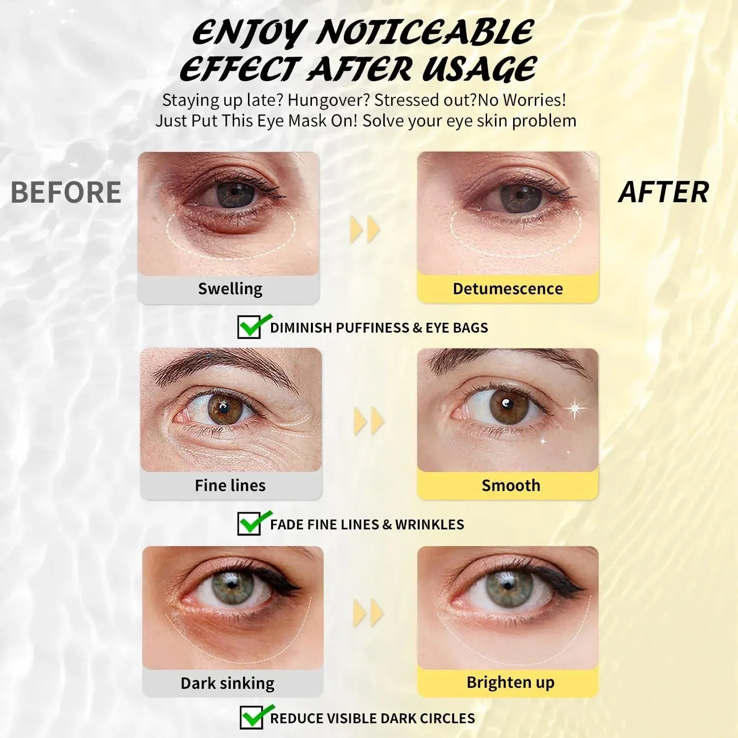 Under Eye Patches (25 Pairs), Hyaluronic Acid Eye Masks