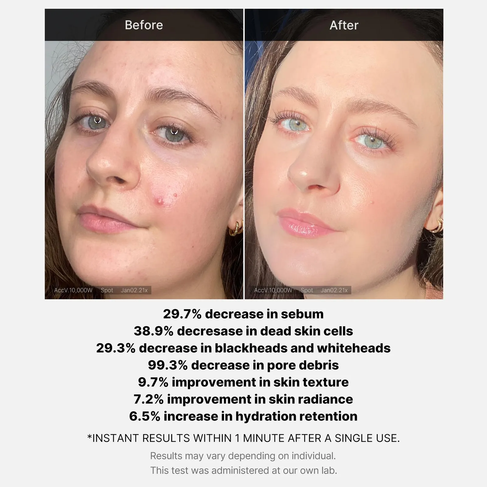Acid Wash-off Exfoliant