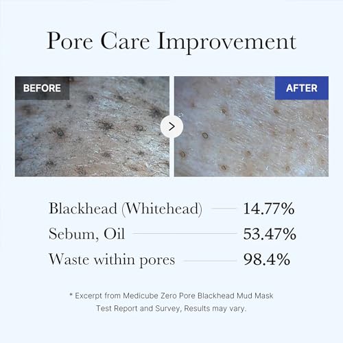 All-in-One Duo - Zero Pore Pads and Zero Pore Blackhead Mud Mask