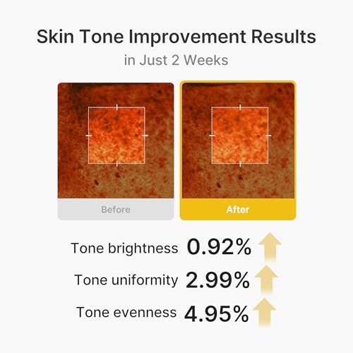 Capsule Cream with Kojic Acid & Turmeric for Uneven Skin Tone