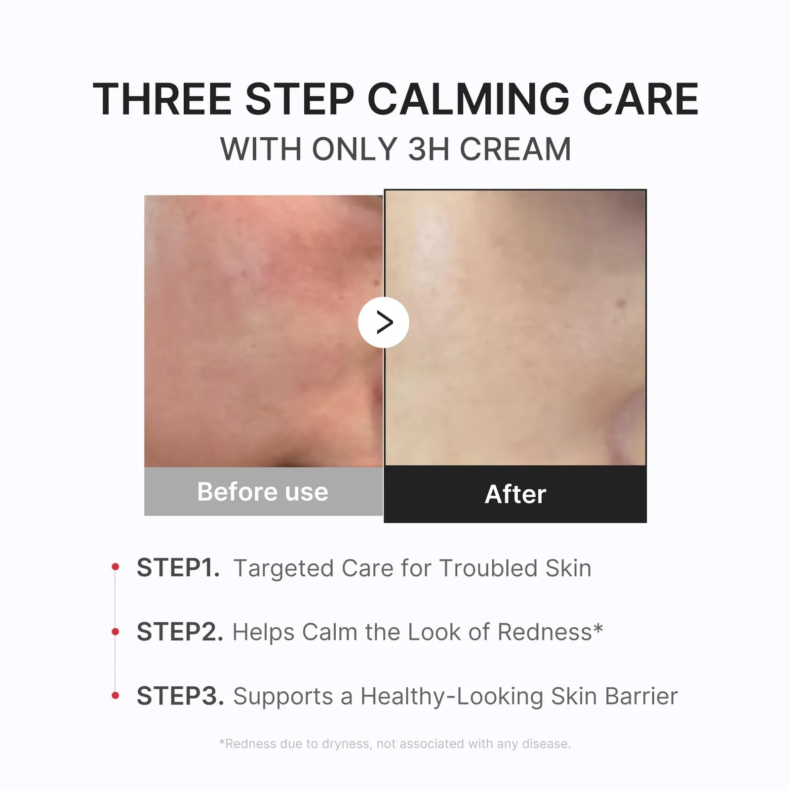 Daily Relief Cream