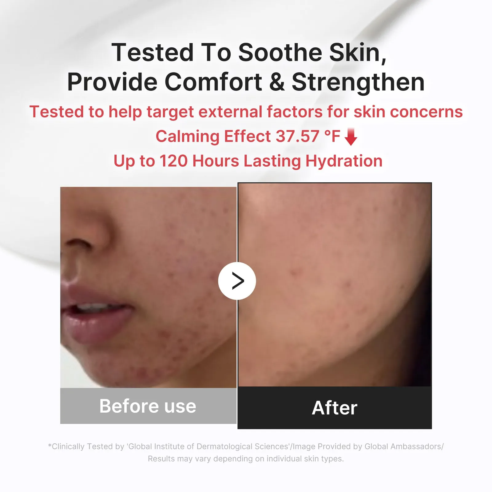 Daily Relief Cream