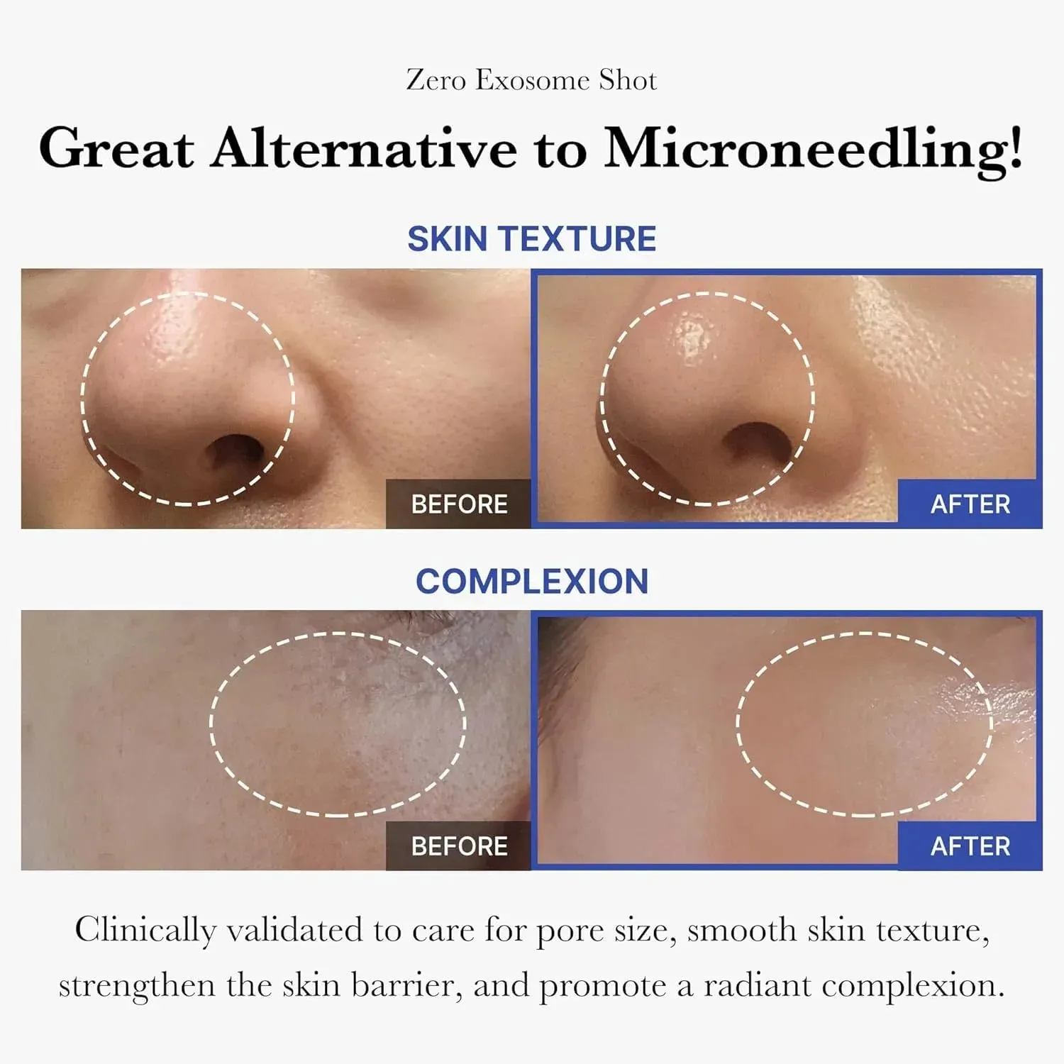 Exosome Facial Serum