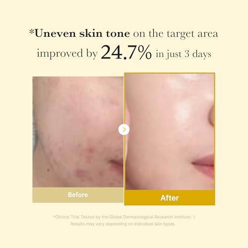 Kojic Acid Turmeric Overnight Wrapping Peel Off Mask – Brightens & Defends Against Skin St