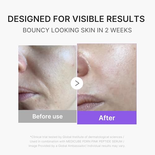 Mini Booster Pro Plus - Portable Facial Device for Radiance