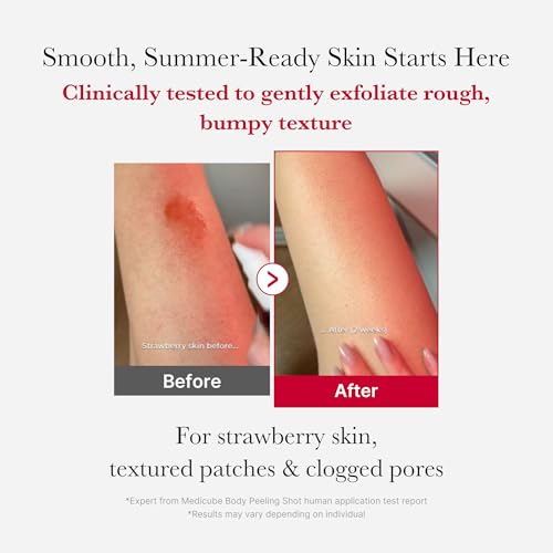 Red Body Peeling Shot - AHA & BHA Exfoliating Body Spray