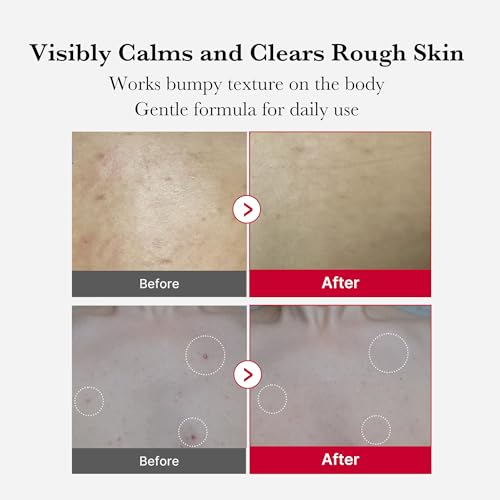 Red Body Peeling Shot - AHA & BHA Exfoliating Body Spray
