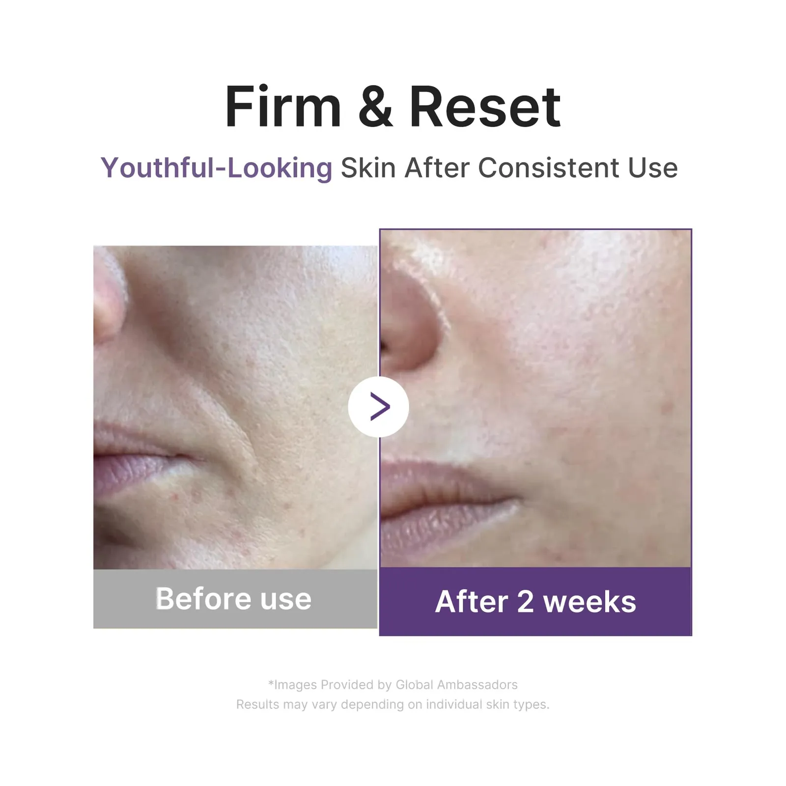 Retinol Boosting Serum