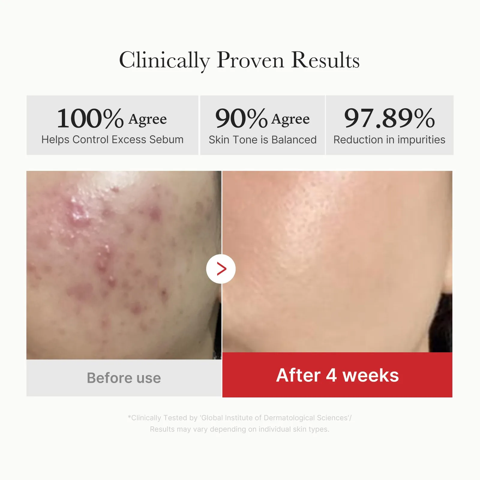 Succinic Acid Toner Pads
