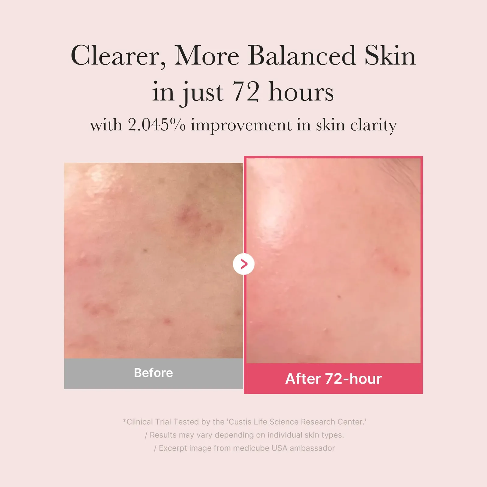 TXA Niacinamide Facial Serum