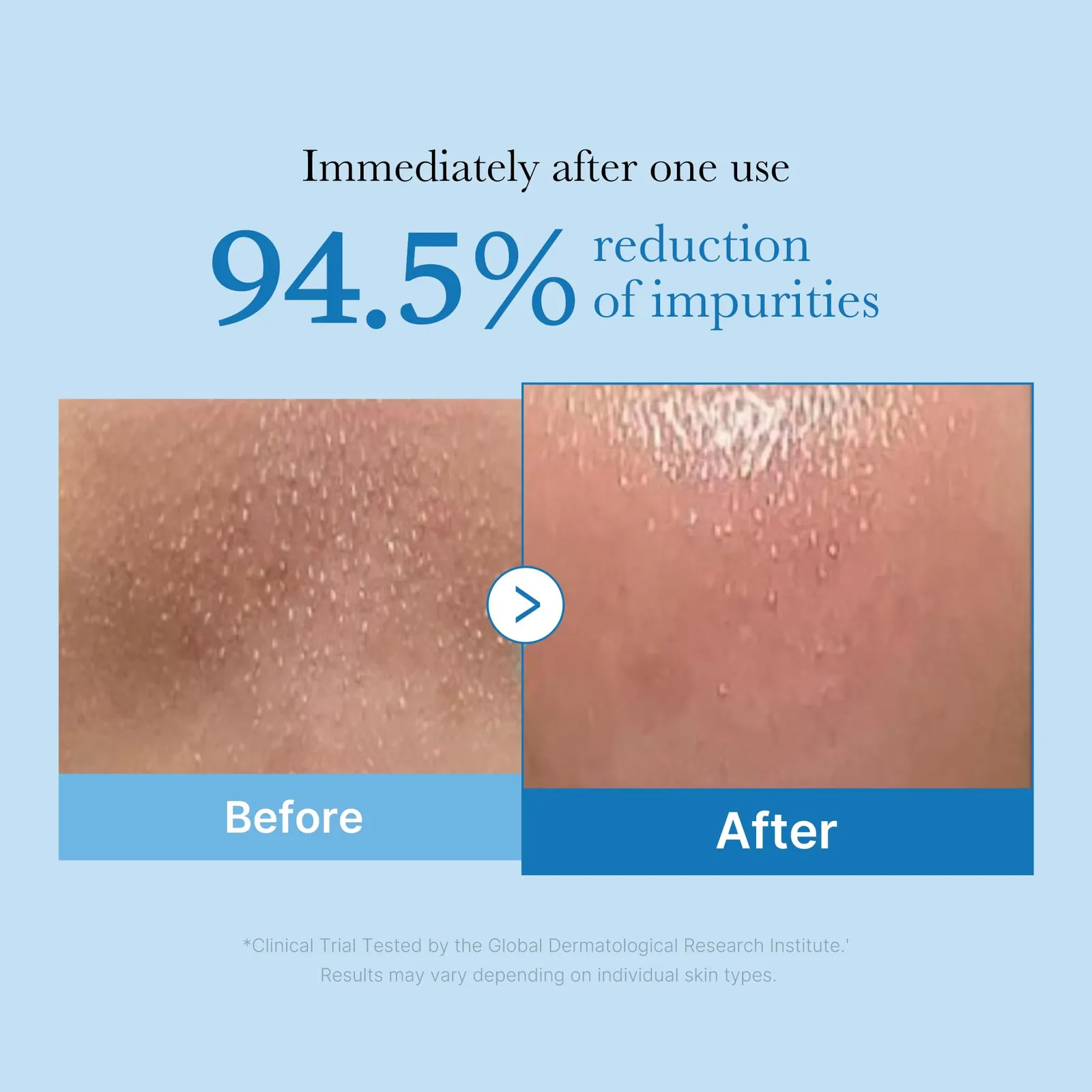 Zero Pore Cleansing Oil