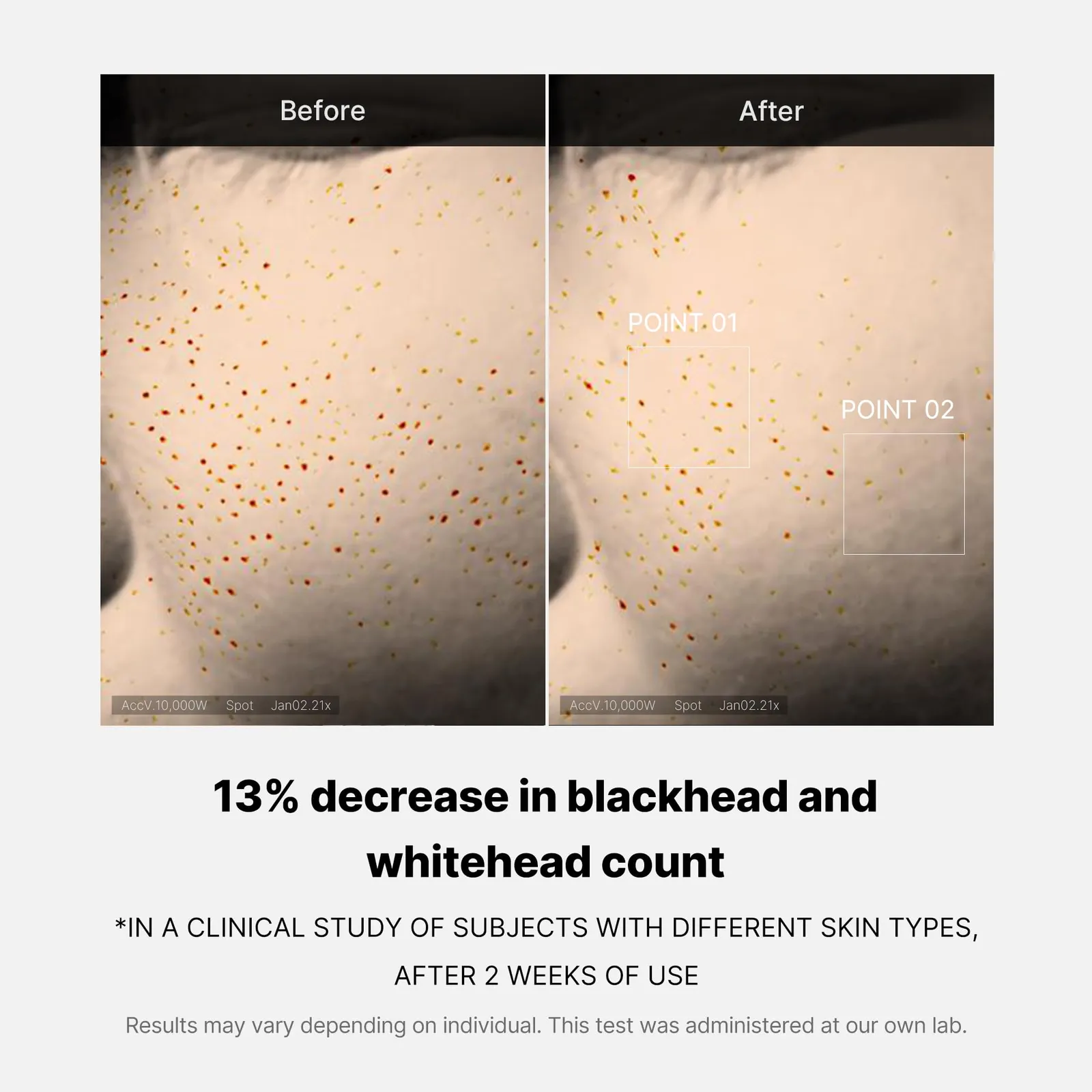 Zero Pore One-Day Serum