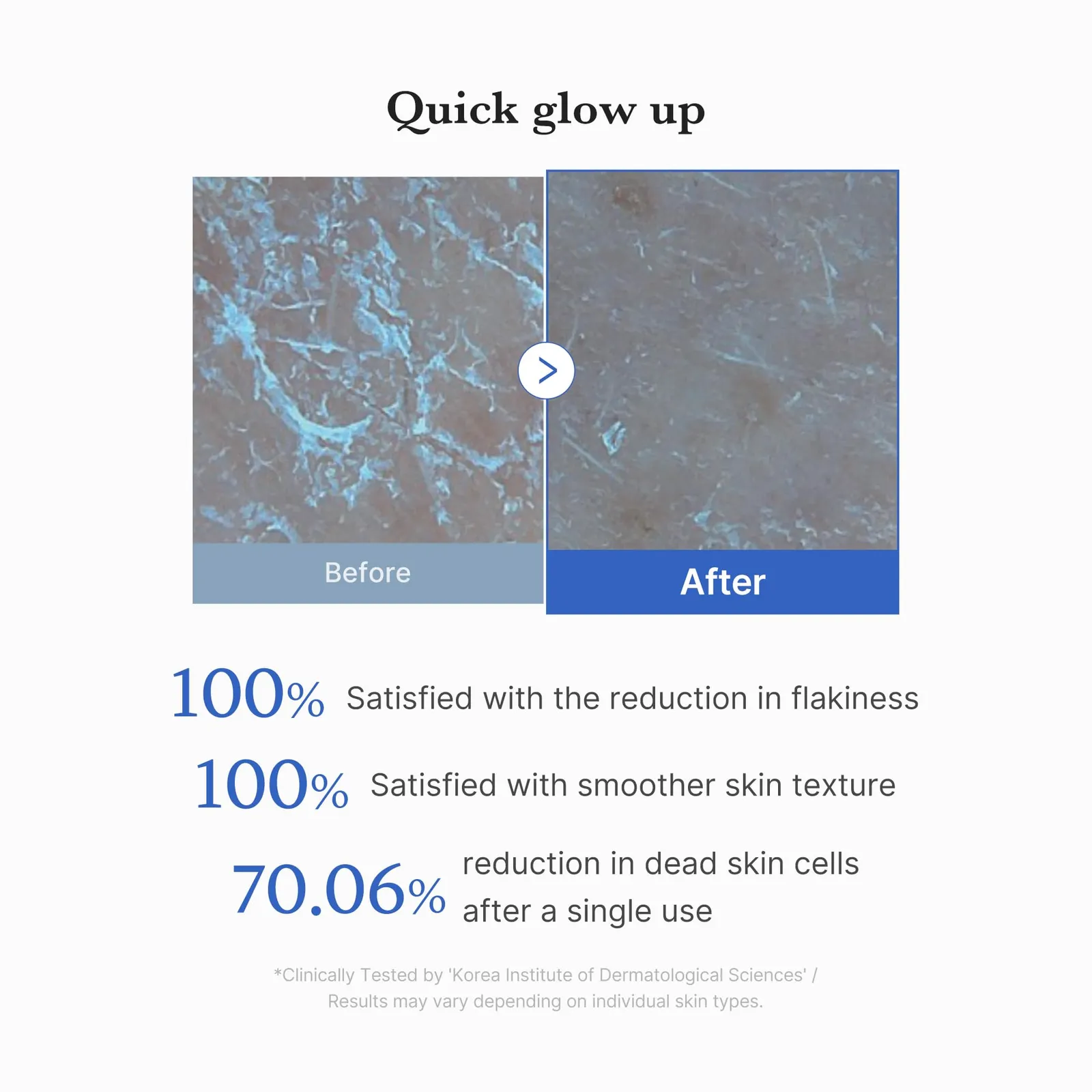 Zero Pore Peel Pads