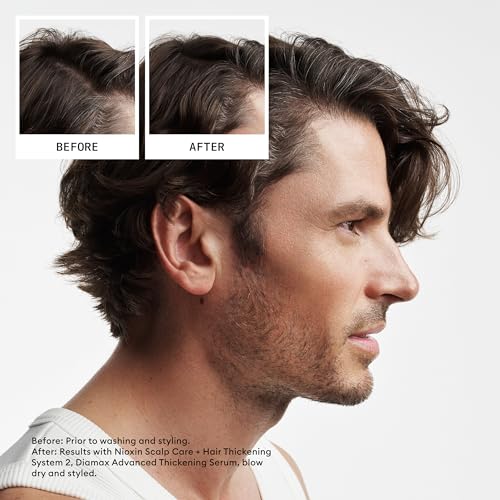 System Kits | Scalp + Hair Thickening | Natural