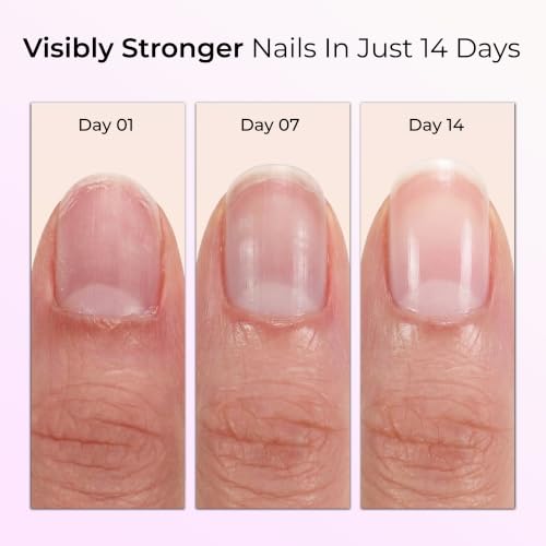 Nailtrition Nail Growth Support