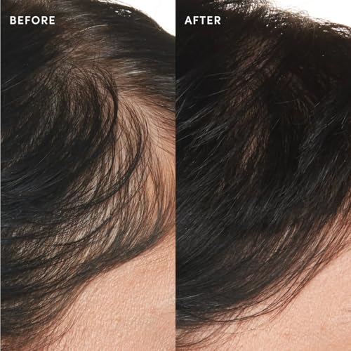 Scalp Serum - Balancing Hair Serum (2 Fl Oz)