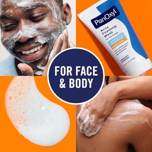 Acne Foaming Wash, 10% Benzoyl Peroxide, For Face & Body