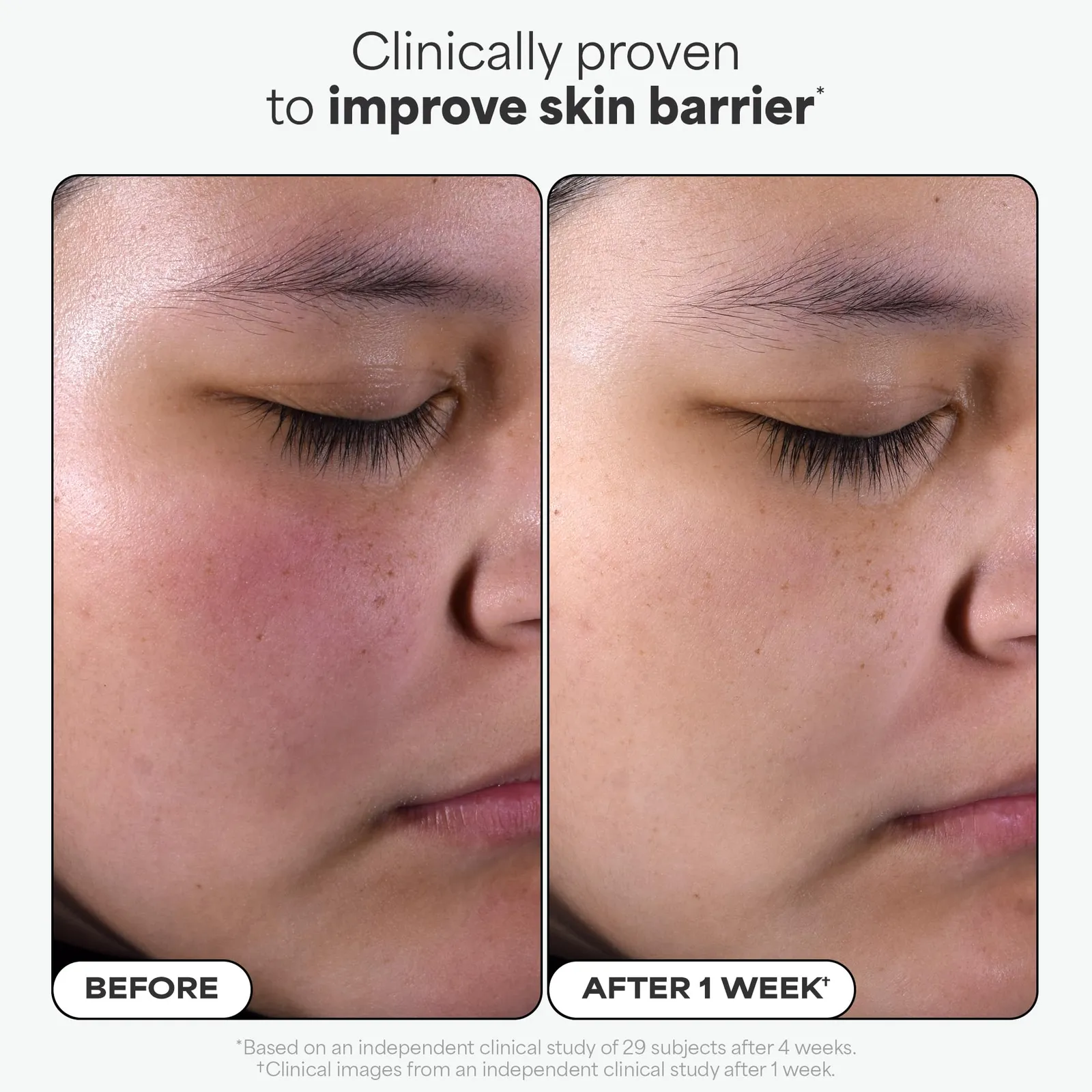 2% BHA Liquid Exfoliant