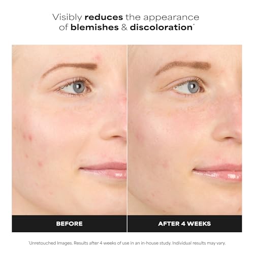 BOOST 10% Azelaic Acid Booster Cream Gel