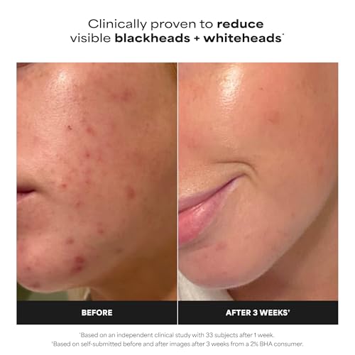 SKIN PERFECTING 2% BHA Liquid Exfoliant