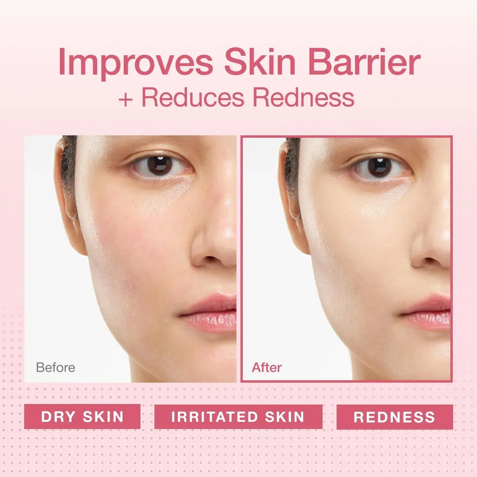 Redness Reducing Cream – Ceramide Moisturizer for Dry, Sensitive & Redness-Prone Skin