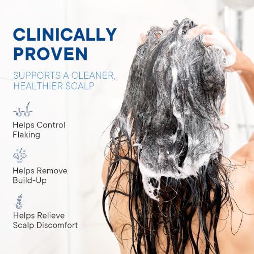 Anti Dandruff shampoo: Antifungal Scalp Treatment for Dandruff