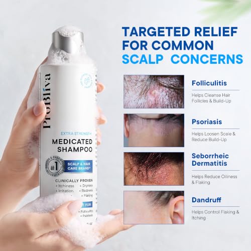 Anti Dandruff shampoo: Antifungal Scalp Treatment for Dandruff