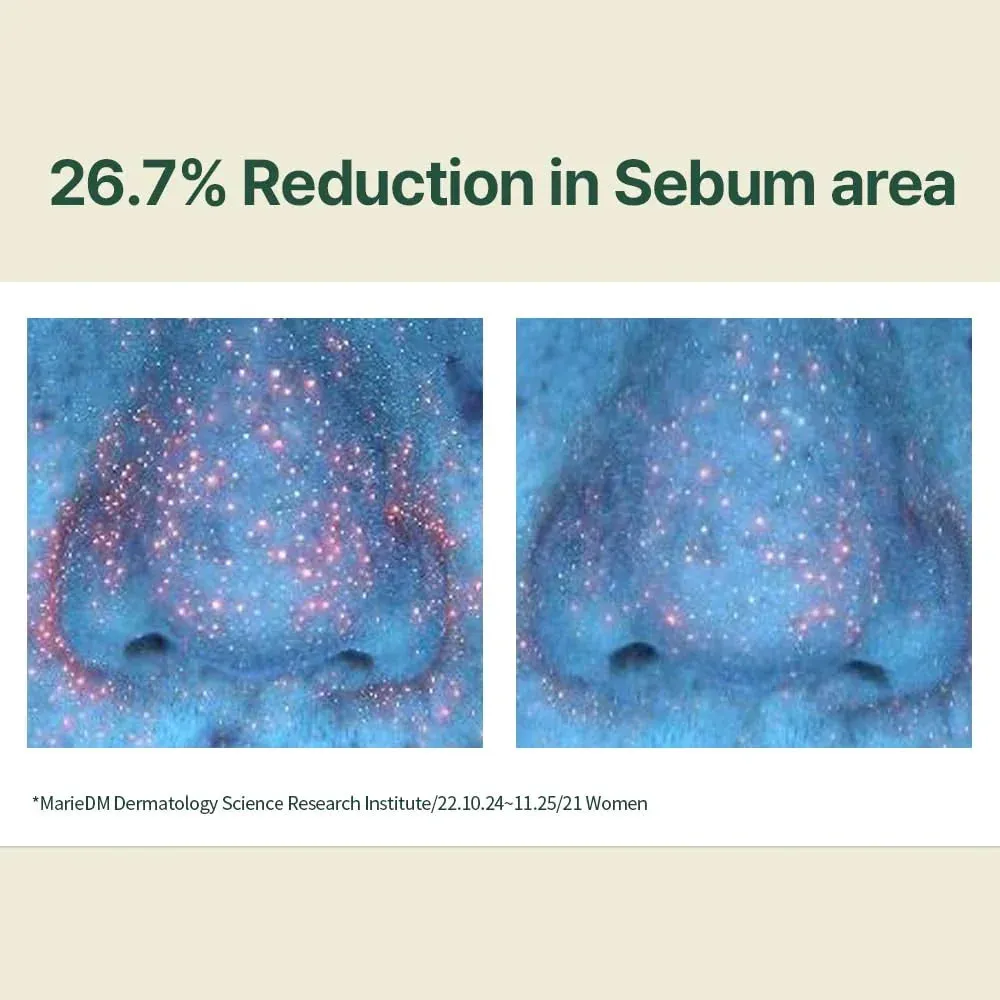 Calming Moisture Serum with Centella Asiatica, Tea Tree, Hyaluronic Acid, Ceramide