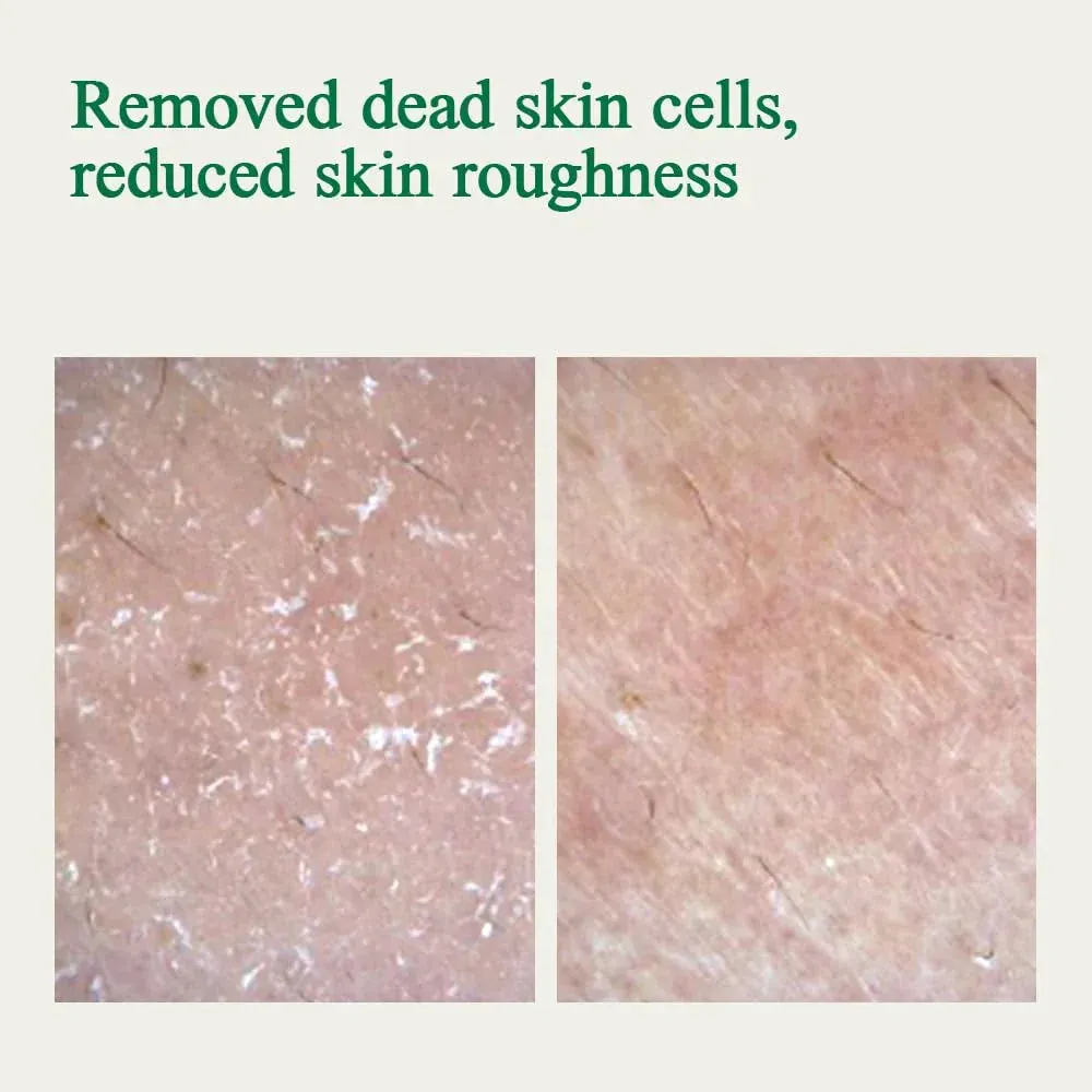PKY Ultimate Calming Solution Ampoule with Cica & Tea Tree