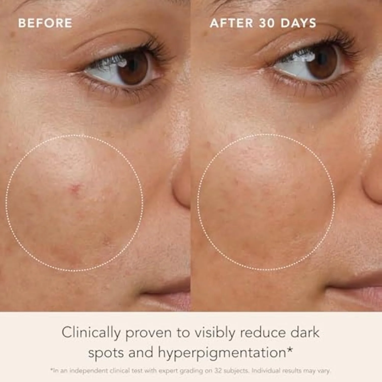 RANAVAT Brightening Saffron Serum - Discoloration Correcting Face Serum, Dark Spot Corrector, Vitamin C Alternative & Hyperpigmentation Treatment - Leaves Skin wit