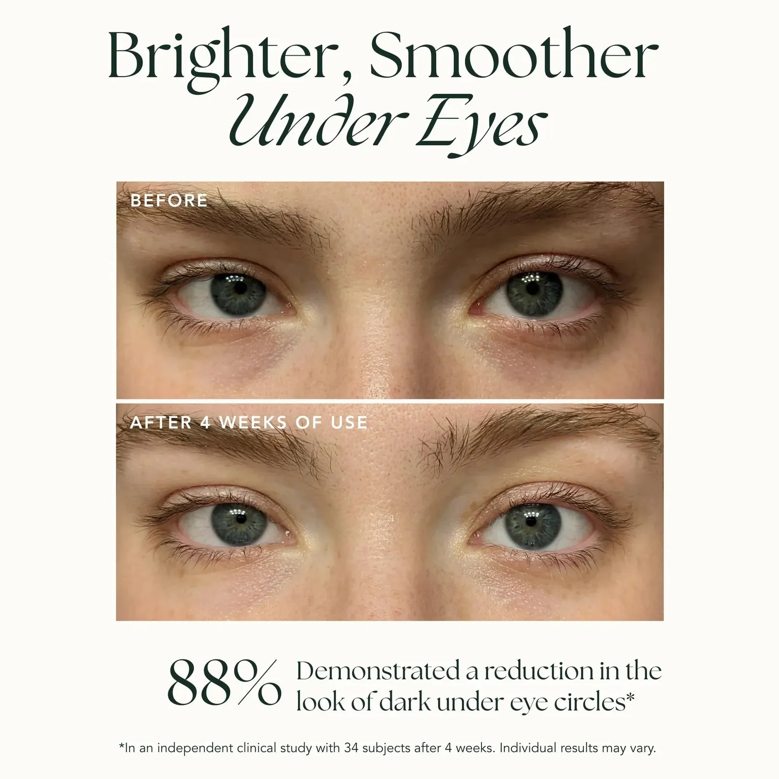Brightening Retinol Eye Cream - Anti Aging Eye Cream and Dark Circle Corrector