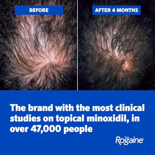 Men's Rogaine 5% Minoxidil Topical Foam