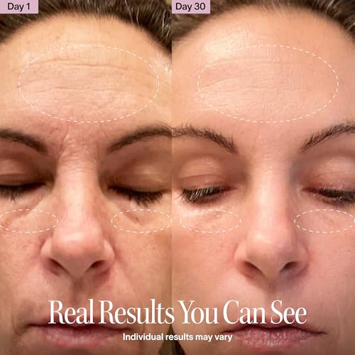 4-in-1 Red Light Therapy Wand for Face & Neck