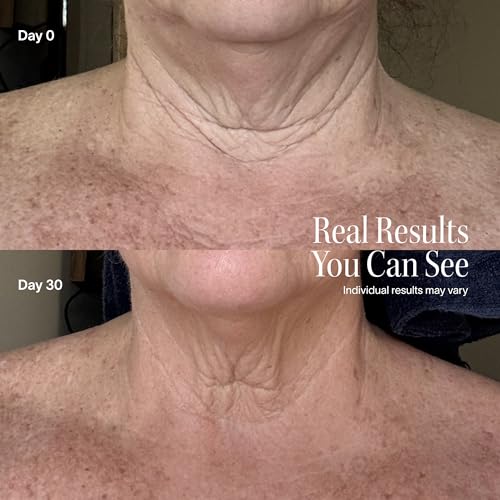 Neck & Chest Red Light Therapy Mask | LED Beauty Device with 4 Wavelengths | Visibly Firms